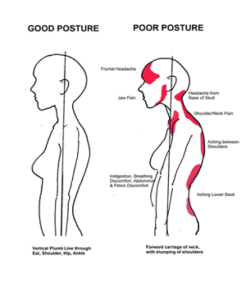Poor Posture due to incorrect breathing